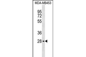 GBL Antibody (C-term) (ABIN1537039 and ABIN2838246) western blot analysis in MDA-M cell line lysates (35 μg/lane). (GBL Antikörper  (C-Term))