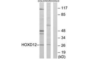 Western blot analysis of extracts from COLO205/HucEc cells, treated with serum 20% 15', using HOXD12 Antibody. (HOXD12 Antikörper  (AA 191-240))