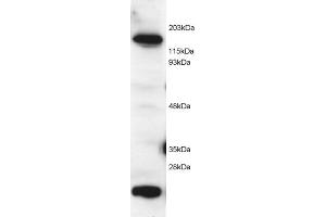 ABIN184584 (2 µg/mL) staining of Hela lysate (RIPA buffer, 1. (MTR Antikörper  (C-Term))