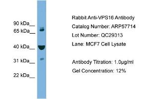 Western Blotting (WB) image for anti-Vacuolar Protein Sorting-Associated Protein 16 Homolog (VPS16) (Middle Region) antibody (ABIN2787354)