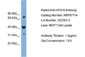 WB Suggested Anti-VPS16  Antibody Titration: 0. (VPS16 Antikörper  (Middle Region))