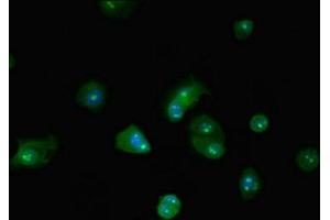 Immunofluorescent analysis of MCF-7 cells using ABIN7145812 at dilution of 1:100 and Alexa Fluor 488-congugated AffiniPure Goat Anti-Rabbit IgG(H+L) (BRD4 Antikörper  (AA 150-200))