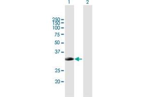 Western Blot analysis of SMN2 expression in transfected 293T cell line by SMN2 MaxPab polyclonal antibody. (SMN2 Antikörper  (AA 1-282))