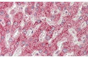 Immunohistochemistry (IHC) image for anti-DNA-Damage-Inducible Transcript 3 (DDIT3) (AA 1-169) antibody (ABIN7437662)