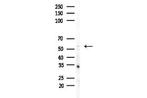 Western blot analysis of lysates from COLO205 cells(heat-shock,45 min treatment), using FCGR1A Antibody at 1/1000 dilution.