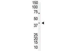 Oct4 antibody used in western blot to detect OCT4 in A375 cell lysate (OCT4 Antikörper  (AA 1-30))