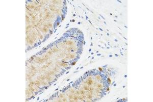 Immunohistochemistry of paraffin-embedded human rectum using ST antibody (ABIN6128538, ABIN6148573, ABIN6148574 and ABIN6222755) at dilution of 1:100 (40x lens). (STAT4 Antikörper  (AA 569-748))