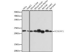 Western blot analysis of extracts of various cell lines, using TCTP/TPT1 Rabbit mAb (ABIN7271101) at 1:1000 dilution. (TPT1 Antikörper)