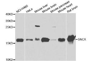 Western blot analysis of extracts of various cell lines, using SNCA antibody. (SNCA Antikörper  (AA 61-140))