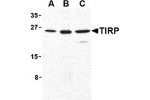 Western blot analysis of TIRP in human (A), mouse (B), and rat (C) kidney cell lysates with this product at 1 μg/ml. (TICAM2 Antikörper  (C-Term))