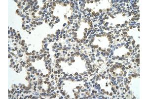 Rabbit Anti-CSTF2 antibody         Paraffin Embedded Tissue:  Human Lung    cell Cellular Data:  alveolar cell    Antibody Concentration:  4. (CSTF2 Antikörper  (N-Term))
