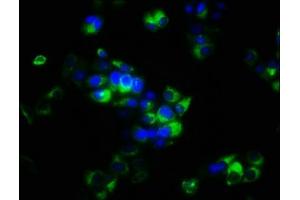 Immunofluorescence (IF) image for anti-Sprouty RTK Signaling Antagonist 4 (SPRY4) (AA 1-299) antibody (ABIN7166152)