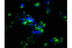 Immunofluorescence staining of PC-3 cells with ABIN7166152 at 1:266, counter-stained with DAPI. (SPRY4 Antikörper  (AA 1-299))