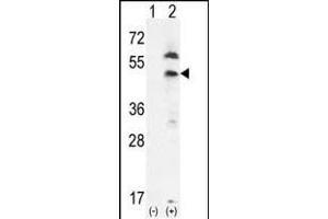 Western blot analysis of PDGFRL (arrow) using rabbit polyclonal PDGFRL- (ABIN392037 and ABIN2841805). (PDGFRL Antikörper  (C-Term))