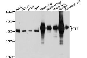 Western blot analysis of extracts of various cell lines, using TST antibody (ABIN4905513) at 1:1000 dilution. (TST Antikörper)