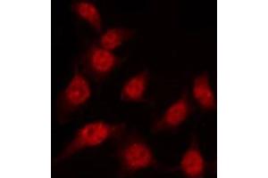 ABIN6267454 staining K562 by IF/ICC.