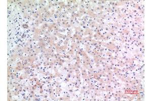 Immunohistochemistry (IHC) analysis of paraffin-embedded Human Liver, antibody was diluted at 1:100. (CD166 Antikörper  (C-Term))