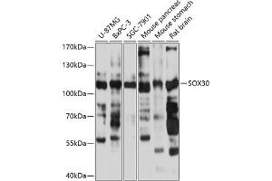 SOX30 Antikörper  (AA 1-150)