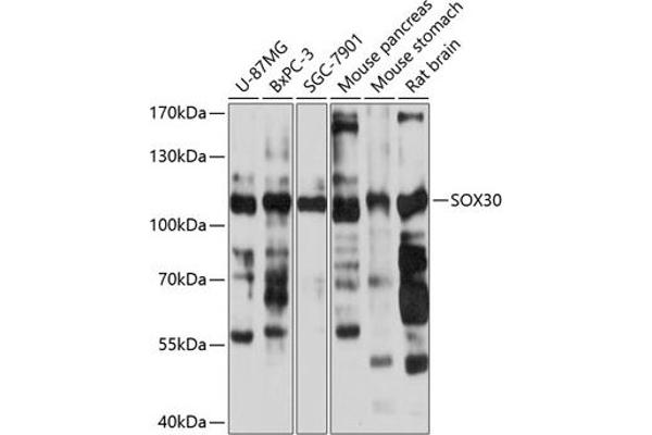 SOX30 Antikörper  (AA 1-150)