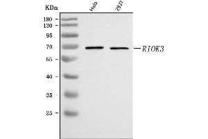 Western blot analysis of RIOK3 using anti-RIOK3 antibody (ABIN7601837).