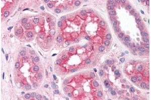 Human Kidney (formalin-fixed, paraffin-embedded) stained with SLC5A1 antibody ABIN364451 at 5 ug/ml followed by biotinylated goat anti-rabbit IgG secondary antibody ABIN481713, alkaline phosphatase-streptavidin and chromogen. (SLC5A1 Antikörper)