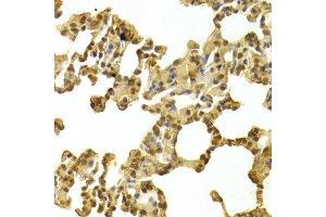 Immunohistochemistry of paraffin-embedded rat lung using CDK4 Antibody. (CDK4 Antikörper  (AA 1-303))