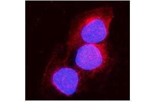 IF analysis of Aconitase 1/ACO1 using anti-Aconitase 1/ACO1 antibody (ABIN7598988).