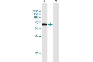 Western Blot analysis of RPN2 expression in transfected 293T cell line by RPN2 MaxPab polyclonal antibody. (Ribophorin II Antikörper  (AA 1-631))