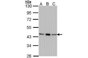 WB Image Sample (30 ug of whole cell lysate) A: 293T B: A431 , C: H1299 10% SDS PAGE antibody diluted at 1:1000 (AHSA1 Antikörper  (Center))