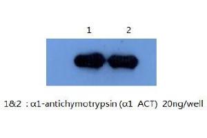 Western Blotting (WB) image for anti-serpin Peptidase Inhibitor, Clade A (Alpha-1 Antiproteinase, Antitrypsin), Member 3 (SERPINA3) antibody (ABIN1105309) (SERPINA3 Antikörper)