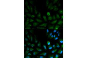 Immunofluorescence analysis of HepG2 cells using CAPZA2 antibody. (CAPZA2 Antikörper)