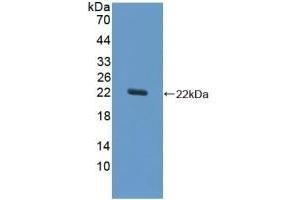 Detection of Recombinant SOD1, Equine using Polyclonal Antibody to Superoxide Dismutase 1 (SOD1) (SOD1 Antikörper  (AA 2-154))