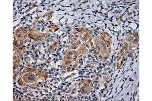 Immunohistochemical staining of paraffin-embedded Kidney tissue using anti-LIPG mouse monoclonal antibody. (LIPG Antikörper)