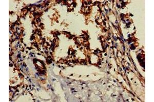Immunohistochemistry of paraffin-embedded human lung tissue using ABIN7147139 at dilution of 1:100 (ITGB1 Antikörper  (AA 297-380))
