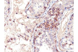 Formalin-fixed, paraffin-embedded human Testicular Carcinoma stained with MAGE-1 Mouse Monoclonal Antibody (MA454). (MAGEA1 Antikörper)