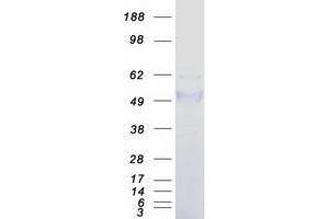 Validation with Western Blot (TCN1 Protein (Myc-DYKDDDDK Tag))