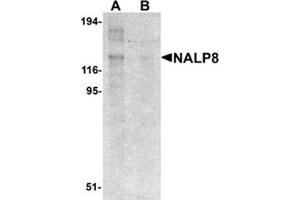 Western blot analysis of NALP8 in human colon tissue lysate with NALP8 antibody at 1 μg/ml in (A) the absence and (B) the presence of blocking peptide. (NALP8 Antikörper  (N-Term))
