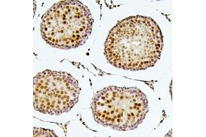IHC analysis of SOX15 using anti-SOX15 antibody (ABIN6719624).