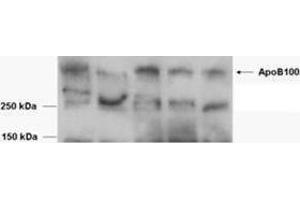 Western Blotting (WB) image for Apolipoprotein B (APOB) peptide (ABIN369954) (Apolipoprotein B (APOB) Peptid)