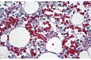 Human Bone Marrow: Formalin-Fixed, Paraffin-Embedded (FFPE) (Red Blood Cell Antikörper)