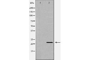 Western blot analysis of extracts of mouse livertissue, using IFNA1 antibody. (IFNA1 Antikörper  (Internal Region))