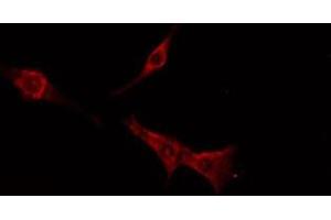 ABIN6276222 staining  MCF7 cells by IF/ICC. (TAS2R16 Antikörper  (Internal Region))