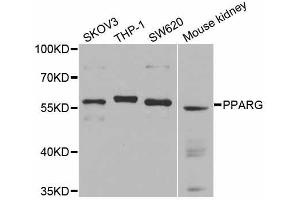 Western blot analysis of extracts of various cell lines, using PPARG antibody (ABIN5970100) at 1/1000 dilution. (PPARG Antikörper  (N-Term))