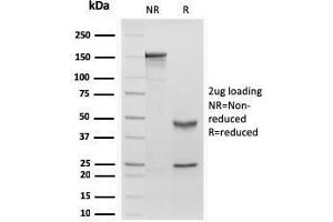 SDS-PAGE Analysis Purified RBP1 Recombinant Mouse Monoclonal Antibody (rRBP1/872). (Rekombinanter RBP4 Antikörper)