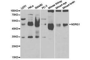 Western Blotting (WB) image for anti-N-Myc Downstream Regulated 1 (NDRG1) antibody (ABIN1873849) (NDRG1 Antikörper)