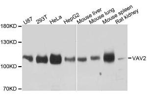 Western blot analysis of extracts of various cell lines, using VAV2 antibody. (VAV2 Antikörper  (AA 570-700))