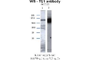 Image no. 2 for anti-Transglutaminase 1, Keratinocyte (TGM1) antibody (ABIN347015) (TGM1 Antikörper)
