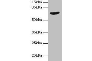 Western blot All lanes: GRK4 antibody at 2 μg/mL + Jurkat whole cell lysate Secondary Goat polyclonal to rabbit IgG at 1/10000 dilution Predicted band size: 67, 64, 58, 62 kDa Observed band size: 67 kDa (GRK4 Antikörper  (AA 1-245))
