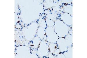 Immunohistochemistry (Paraffin-embedded Sections) (IHC (p)) image for anti-Sialophorin (SPN) (AA 276-400) antibody (ABIN6148363)
