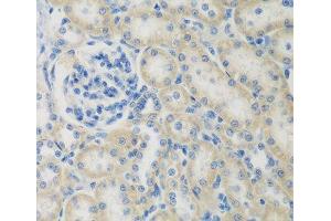 Immunohistochemistry of paraffin-embedded Rat kidney using CCL26 Polyclonal Antibody at dilution of 1:200 (40x lens). (CCL26 Antikörper)